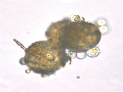 Labyrinthulomycetes on pollen grains